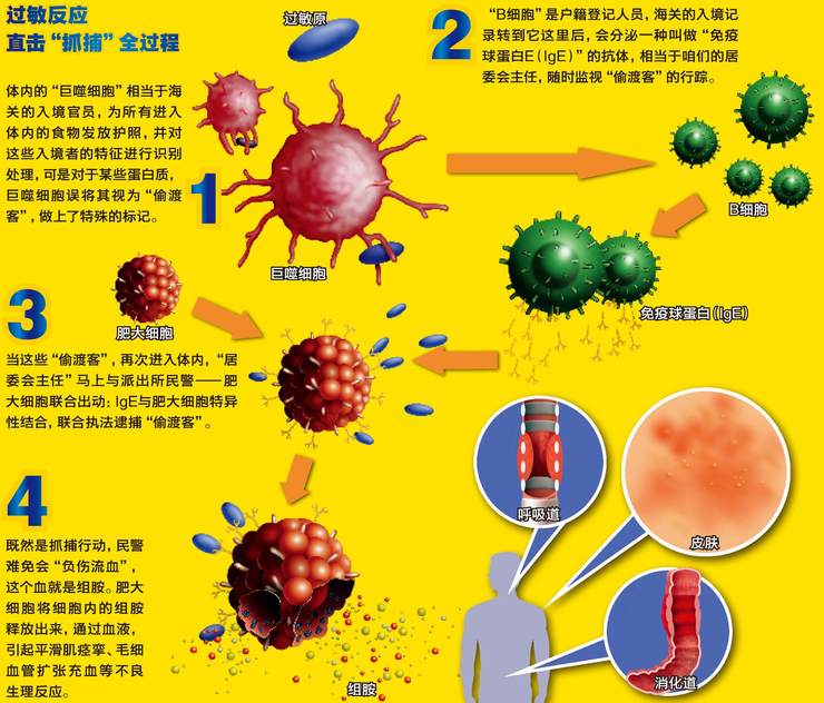 过敏反应