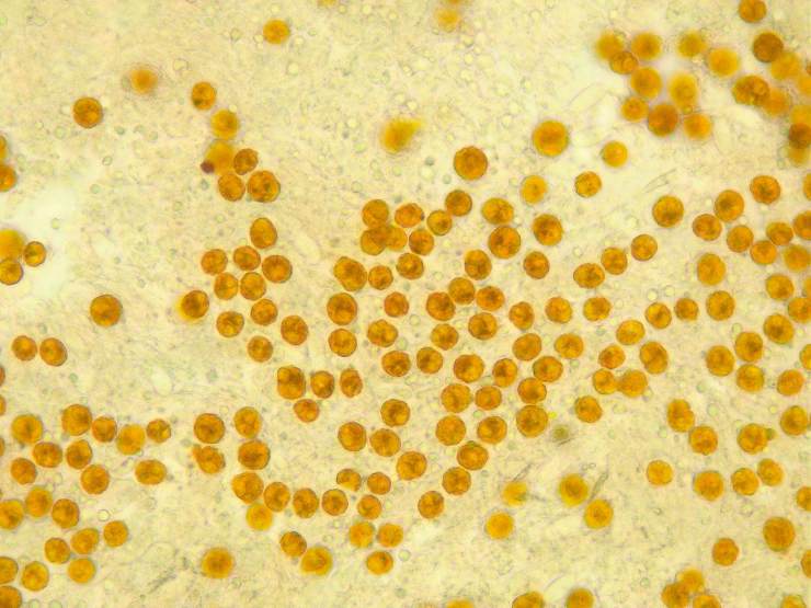 虫黄藻是一种单细胞海藻,直径只有微米级别.